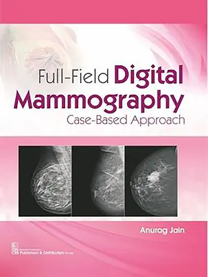 Celoplošná digitálna mamografia: Prípadový prístup - Full-Field Digital Mammography: Case-Based Approach