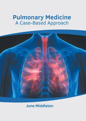 Pľúcne lekárstvo: Pľúcne lekárstvo: Prístup založený na konkrétnych prípadoch - Pulmonary Medicine: A Case-Based Approach