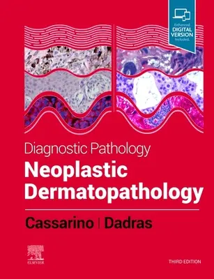 Diagnostická patológia: Neoplastická dermatopatológia - Diagnostic Pathology: Neoplastic Dermatopathology