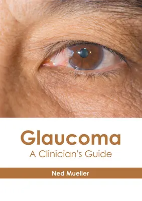 Glaukóm: Príručka pre lekára - Glaucoma: A Clinician's Guide