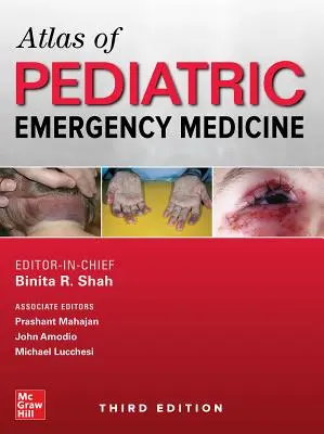 Atlas pediatrickej urgentnej medicíny, tretie vydanie - Atlas of Pediatric Emergency Medicine, Third Edition