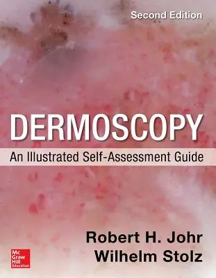 Dermoskopia: Ilustrovaný sprievodca sebahodnotením, 2/E - Dermoscopy: An Illustrated Self-Assessment Guide, 2/E