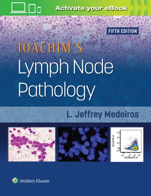 Ioachimova patológia lymfatických uzlín - Ioachim's Lymph Node Pathology