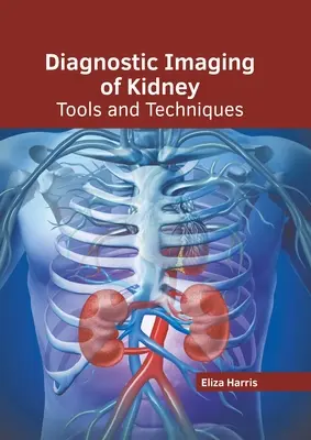 Diagnostické zobrazovanie obličiek: Nástroje a techniky - Diagnostic Imaging of Kidney: Tools and Techniques