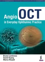 Angio Oct v každodennej oftalmologickej praxi - Angio Oct in Everyday Ophthalmic Practice