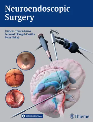 Neuroendoskopická chirurgia - Neuroendoscopic Surgery