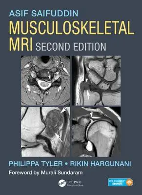 Magnetická rezonancia pohybového aparátu - Musculoskeletal MRI