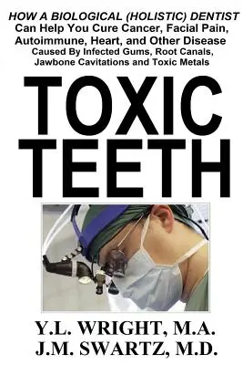 Toxické zuby: Ako vám môže biologický (holistický) zubár pomôcť vyliečiť rakovinu, bolesť tváre, autoimunitné, srdcové a iné choroby spôsobené - Toxic Teeth: How a Biological (Holistic) Dentist Can Help You Cure Cancer, Facial Pain, Autoimmune, Heart, and Other Disease Caused
