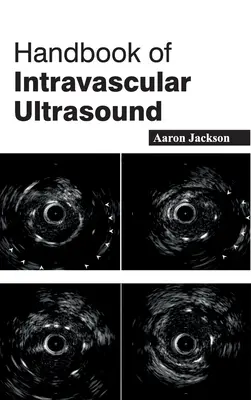 Príručka intravaskulárneho ultrazvuku - Handbook of Intravascular Ultrasound