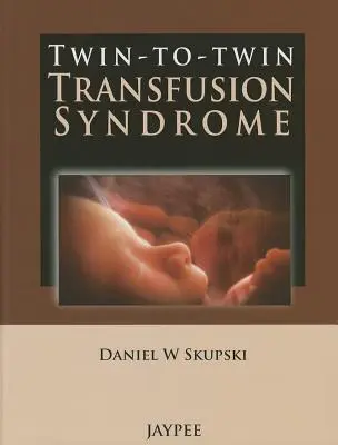 Syndróm transfúzie medzi dvojčatami - Twin-To-Twin Transfusion Syndrome
