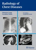 Rádiológia ochorení hrudníka - Radiology of Chest Diseases