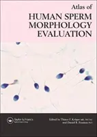 Atlas morfologického hodnotenia ľudských spermií - Atlas of Human Sperm Morphology Evaluation