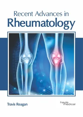 Najnovšie pokroky v reumatológii - Recent Advances in Rheumatology