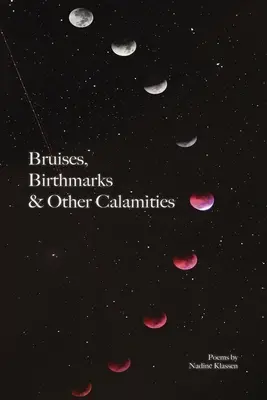 Modriny, materské znamienka a iné nešťastia - Bruises, Birthmarks & Other Calamities