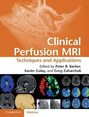Klinická perfúzna MR: Techniky a aplikácie - Clinical Perfusion MRI: Techniques and Applications