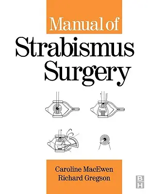 Príručka chirurgie strabizmu - Manual of Strabismus Surgery