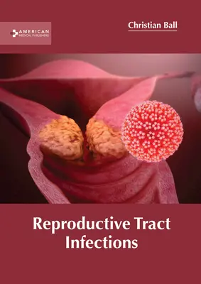 Infekcie reprodukčných ciest - Reproductive Tract Infections