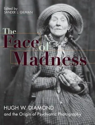 Tvár šialenstva: Hugh W. Diamond a vznik psychiatrickej fotografie - Face of Madness: Hugh W. Diamond and the Origin of Psychiatric Photography