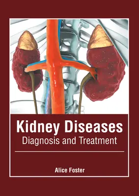 Choroby obličiek: Diagnostika a liečba - Kidney Diseases: Diagnosis and Treatment
