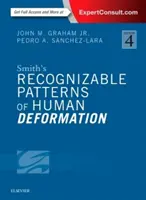Smithove rozpoznateľné vzorce deformácie človeka - Smith's Recognizable Patterns of Human Deformation