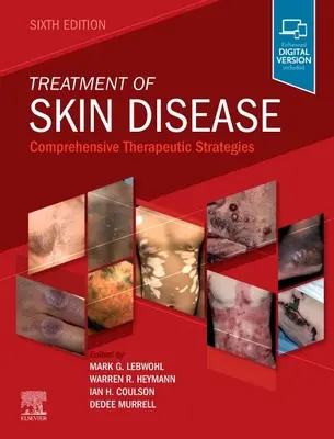 Liečba kožných ochorení: Komplexné terapeutické stratégie - Treatment of Skin Disease: Comprehensive Therapeutic Strategies