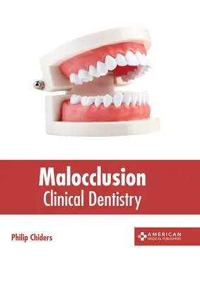 Maloklúzia: Klinická stomatológia - Malocclusion: Clinical Dentistry