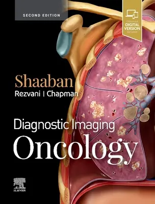 Diagnostické zobrazovanie: Onkológia - Diagnostic Imaging: Oncology