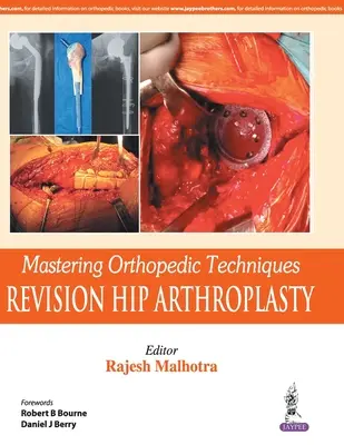 Mastering Orthopedic Techniques: Revízna totálna artroplastika bedrového kĺbu - Mastering Orthopedic Techniques: Revision Total Hip Arthroplasty