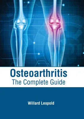 Osteoartritída: Vydanie: Kompletný sprievodca - Osteoarthritis: The Complete Guide