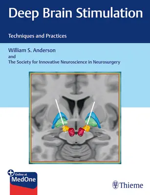 Hlboká stimulácia mozgu: Stimulácia mozgu: techniky a postupy - Deep Brain Stimulation: Techniques and Practices