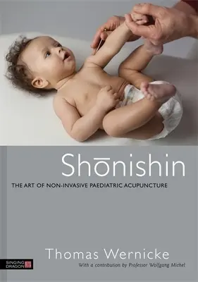 Šonišin: Umenie neinvazívnej detskej akupunktúry - Shonishin: The Art of Non-Invasive Paediatric Acupuncture