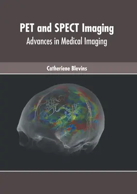Zvieracie a spektrálne zobrazovanie: Pokroky v lekárskom zobrazovaní - Pet and Spect Imaging: Advances in Medical Imaging