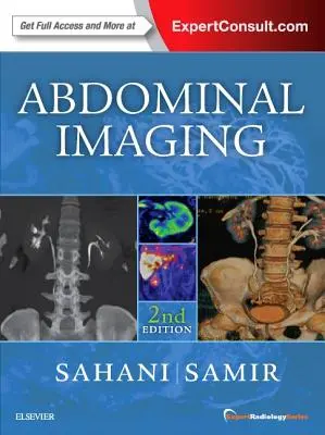 Zobrazovanie brucha: Séria odborných rádiologických publikácií - Abdominal Imaging: Expert Radiology Series