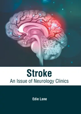 Úder: Vydanie Neurologickej kliniky - Stroke: An Issue of Neurology Clinics