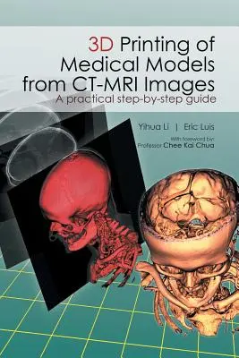 3D tlač lekárskych modelov zo snímok CT-MRI: Praktický sprievodca krok za krokom - 3D Printing of Medical Models from CT-MRI Images: A Practical step-by-step guide