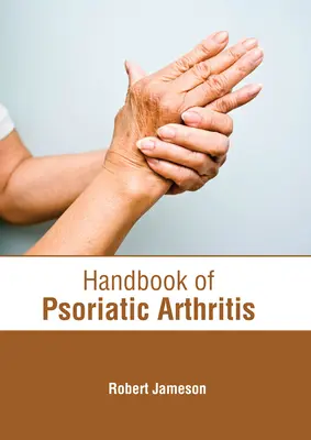 Príručka psoriatickej artritídy - Handbook of Psoriatic Arthritis