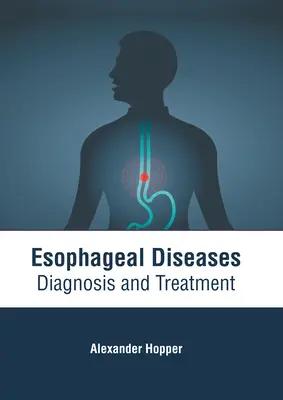 Choroby pažeráka: Diagnostika a liečba - Esophageal Diseases: Diagnosis and Treatment