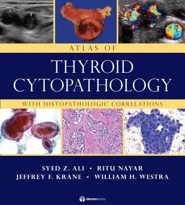 Atlas cytopatológie štítnej žľazy: S histopatologickými koreláciami - Atlas of Thyroid Cytopathology: With Histopathologic Correlations
