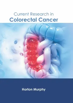 Súčasný výskum kolorektálneho karcinómu - Current Research in Colorectal Cancer