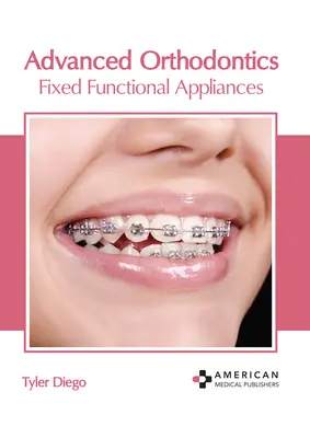 Pokročilá ortodoncia: Fixné funkčné aparáty - Advanced Orthodontics: Fixed Functional Appliances