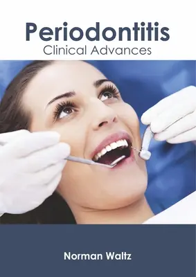 Paradentóza: Klinické pokroky - Periodontitis: Clinical Advances