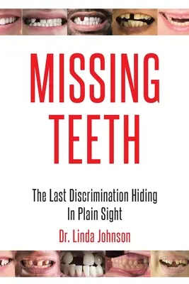 Chýbajúce zuby: Posledná diskriminácia, ktorá sa skrýva na prvý pohľad - Missing Teeth: The Last Discrimination Hiding in Plain Sight