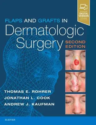 Lapy a štepy v dermatologickej chirurgii - Flaps and Grafts in Dermatologic Surgery