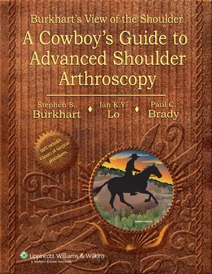Burkhartov pohľad na rameno - Sprievodca kovbojov pokročilou artroskopiou ramena - Burkhart's View of the Shoulder - A Cowboy's Guide to Advanced Shoulder Arthroscopy