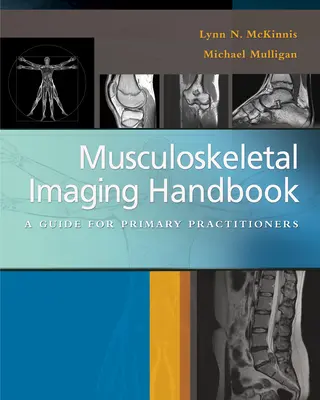 Príručka zobrazovania pohybového aparátu: Príručka pre lekárov prvého kontaktu - Musculoskeletal Imaging Handbook: A Guide for Primary Practitioners