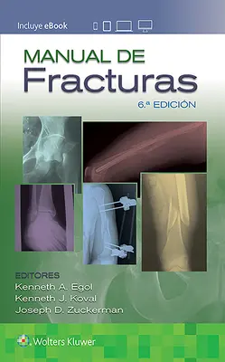 Príručka o zlomeninách - Manual de Fracturas