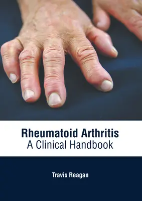 Reumatoidná artritída: Klinická príručka - Rheumatoid Arthritis: A Clinical Handbook