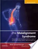 Syndróm nesúladu: Diagnostika a liečba bežných bolestí panvy a chrbta - The Malalignment Syndrome: Diagnosis and Treatment of Common Pelvic and Back Pain