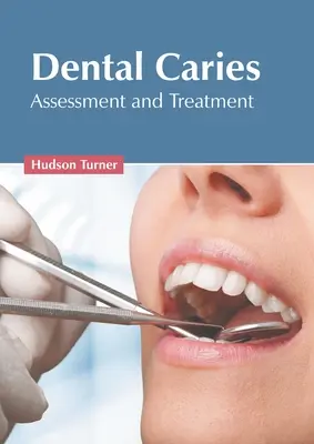 Zubný kaz: Hodnotenie a liečba - Dental Caries: Assessment and Treatment