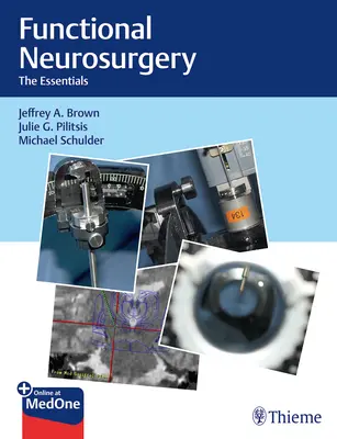Funkčná neurochirurgia: Základné informácie o neurochirurgii - Functional Neurosurgery: The Essentials